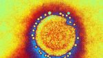 Penampakan Virus Flu Burung Lewat Mikroskop