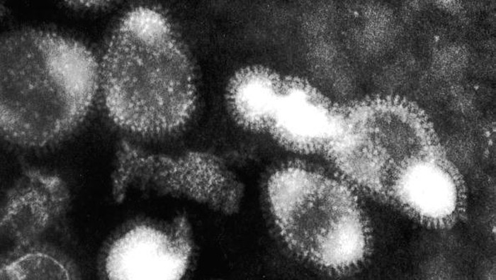 HONG KONG, HONG KONG:  This undated hand out photo shows the H5N1 or bird flu virus as seen through a microscope. The virus has killed two people in Hong Kong and public concern has grown since officials admitted it was possible that it could be passed from human-to-human. Daniel Lavanchy, head of the World Health Organization Influenza Program, and a team of the worlds top flu experts are on their way to Hong Kong to investigate the virus. AFP PHOTO (Photo credit should read AFP/Getty Images)