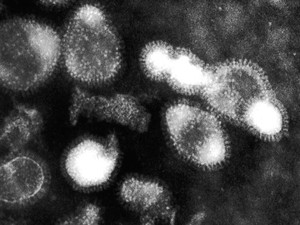 Bocah 11 Tahun di Kamboja Tewas Akibat Flu Burung, Ayahnya Terinfeksi