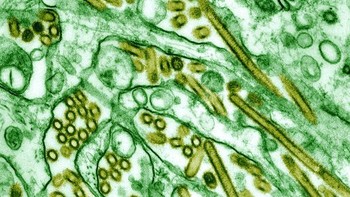 Kalau ini adalah tampilan dari virus influenza A tipe H5N1. Foto: Getty Images