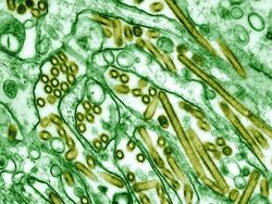 Cantik Tapi Berbahaya, Potret Virus di Bawah Lensa Mikroskop