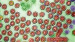 Penampakan Virus Flu Burung Lewat Mikroskop