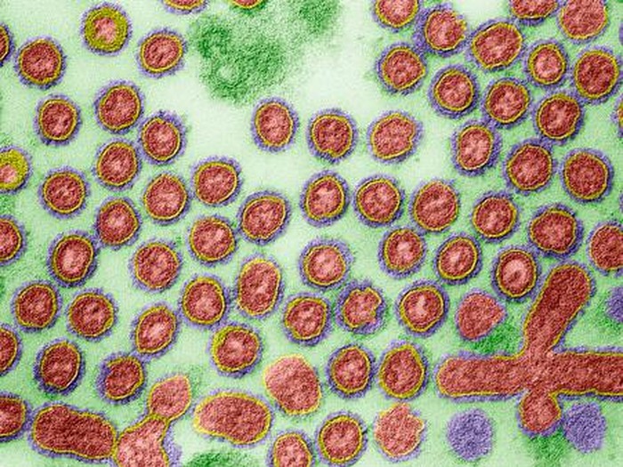 Contoh penampakan virus flu burung strain H7N9. (Foto: Getty Images) Contoh penampakan virus flu burung strain H7N9. (Foto: Getty Images)
