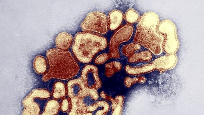Transmission Electron Micrograph Of Swine Influenza Virus. False Color Transmission Electron Micrograph Tem Of The Swine Fever Virus. Under A Plate Magnification Of 37,800X, This Colorized Transmission Electron Micrograph Tem Depicted The A/New Jersey/76 Hsw1N1 Virus, While In The Virus? First Developmental Passage Through A Chicken Egg. Swine Influenza Swine Flu Is A Respiratory Disease Of Pigs Caused By Type A Influenza That Regularly Cause Outbreaks Of Influenza Among Pigs. Swine Flu Viruses Cause High Levels Of Illness And Low Death Rates Among Pigs. Swine Influenza Viruses May Circulate In Swine Throughout The Year, But Most Outbreaks Among Swine Herds Occur During The Late Fall And Winter Months Similar To Humans. The Classical Swine Flu Virus An Influenza Type A H1N1 Virus Was First Isolated From A Pig In 1930. Swine Flu Viruses Do Not Normally Infect Humans. However, Sporadic Human Infections With Swine Flu Have Occurred. In The Past Several Years, On Average Cdc Has Received About One Influenza Virus Isolate From A Human That Tests Positive For Swine Flu Each Year. Most Commonly, These Cases Occur In Persons With Direct Exposure To Pigs Workers In The Swine Industry, For Example. In Addition, There Have Been Rare Documented Cases Of One Person Spreading Swine Flu To Others. For Example, An Outbreak Of Apparent Swine Flu Infection In Pigs In Wisconsin In 1988 Resulted In Multiple Human Infections, And, Although No Community Outbreak Resulted, There Was Antibody Evidence Of Virus Transmission From The Patient To Health Care Workers Who Had Close Contact With The Patient. (Photo By BSIP/UIG Via Getty Images)