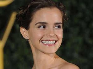 Pose Tanpa Bra, Emma Watson Disebut Munafik