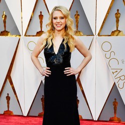 Kate McKinnon Ngaku Idap Geographic Tongue