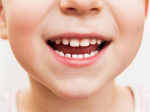 Voucher Perawatan Gigi Anak Bisa Didapatkan di Sini