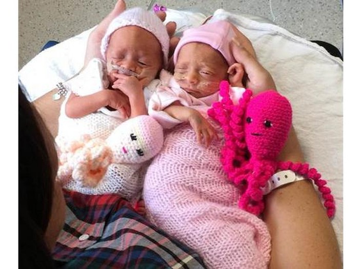 Agar Nyaman, Bayi Prematur di RS Ini Ditemani Boneka Gurita