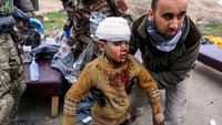 Seorang bocah tengah berjalan menuju ambulans setelah mendapat pertolongan pertama dari petugas usai terkena serangan mortir di Mosul Barat, Irak, Kamis (2/3/2017). REUTERS/Zohra Bensemra.