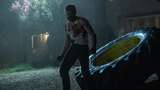 Hugh Jackman Cedera Pita Suara Gegara Perankan Wolverine