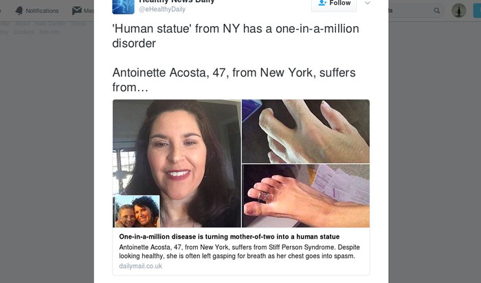 Gerak Sedikit Saja, Wanita Ini Bisa Tiba-tiba Kejang dan Kaku