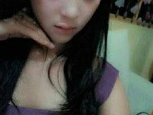 Disiram Air Keras, Perempuan Cantik ini Terancam Buta Permanen