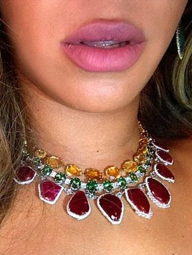 Bibir Beyonce Tampak Lebih Tebal, Ini Penjelasan Dokter