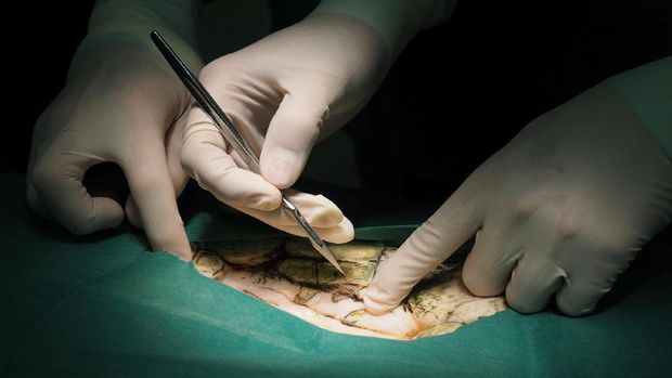 Omsin saat dioperasi