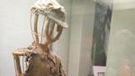 Potret Sedih Korban Bom Atom di Museum Perdamaian Hiroshima