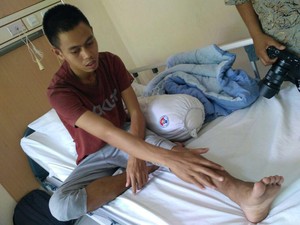 RSON Tangani Cedera Patah Tulang Mantan Pemain Persibat Batang Hapidin