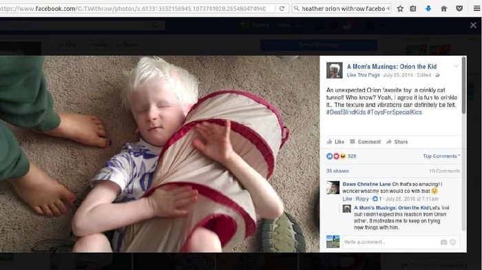 Perjalanan Orion, Bocah yang Tuli, Buta dan Bisu karena Kondisi Langka