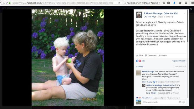 Perjalanan Orion, Bocah yang Tuli, Buta dan Bisu karena Kondisi Langka 