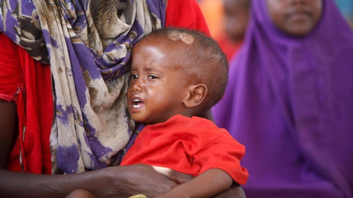Potret anak yang mengalami masalah kekeringan di Somalia. (Foto: Reuters) Potret anak yang mengalami masalah kekeringan di Somalia. (Foto: Reuters)