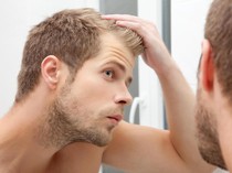 Sering Minum Soda Picu Kerontokan Rambut Menurut Penelitian