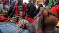 Pada Februari lalu UNICEF mengatakan, kekeringan di Somalia menyebabkan sekitar 270.000 anak menderita kekurangan gizi. Feisal Omar/Reuters.