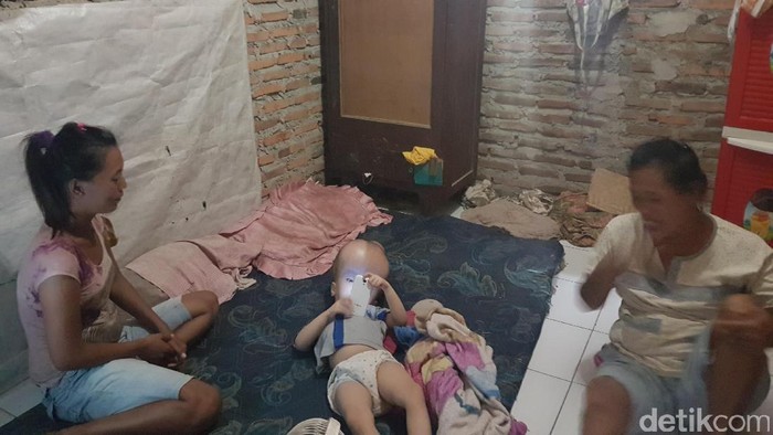 Ilham Bocah Penderita Hidrosefalus di Serang Butuh Bantuan