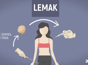 Video: Berapa Ukuran Ideal untuk Payudara?