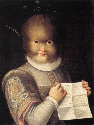 Sindrom Manusia Serigala di Balik Kisah Beauty and The Beast