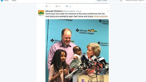 Operasi Sukses, Bayi dengan 4 Kaki dan 2 Tulang Belakang Bisa Hidup Normal