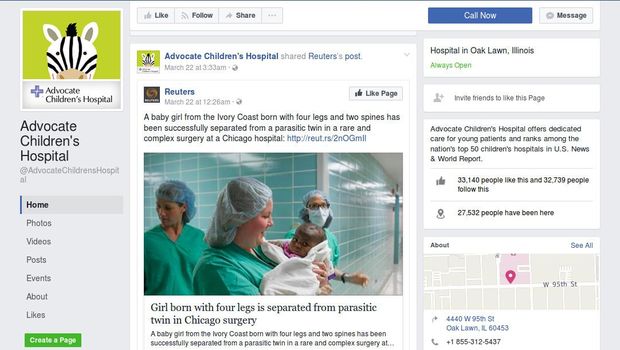 Operasi Sukses, Bayi dengan 4 Kaki dan 2 Tulang Belakang Bisa Hidup Normal