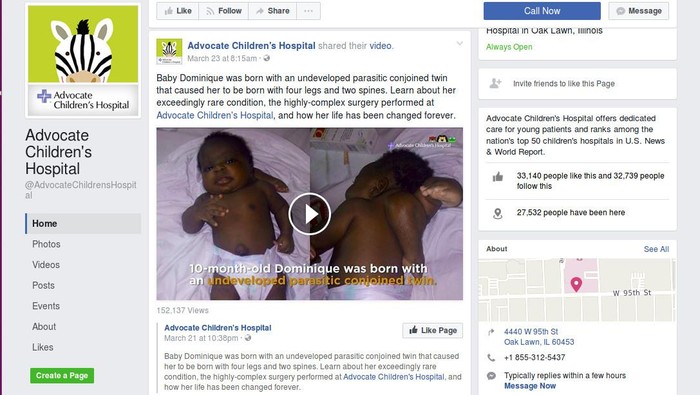 Operasi Sukses, Bayi dengan 4 Kaki dan 2 Tulang Belakang Bisa Hidup Normal