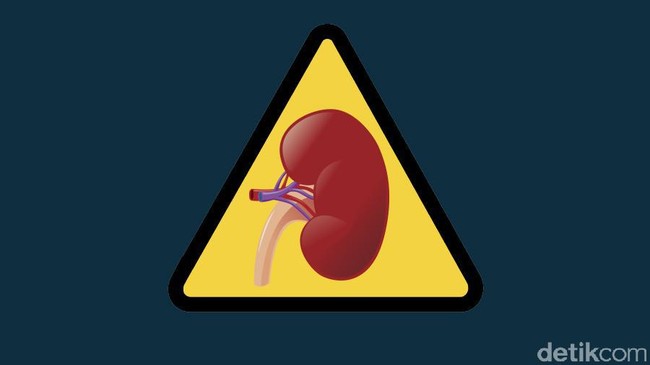 Hidup dengan Satu Ginjal? Ini Dampak dan Caranya Agar Tetap Sehat