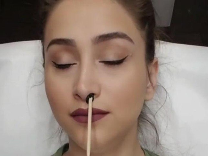 Waxing bulu hidung seperti yang dilakukan wanita ini tidak dianjurkan. (Foto: Instagram) Waxing bulu hidung seperti yang dilakukan wanita ini tidak dianjurkan. (Foto: Instagram)