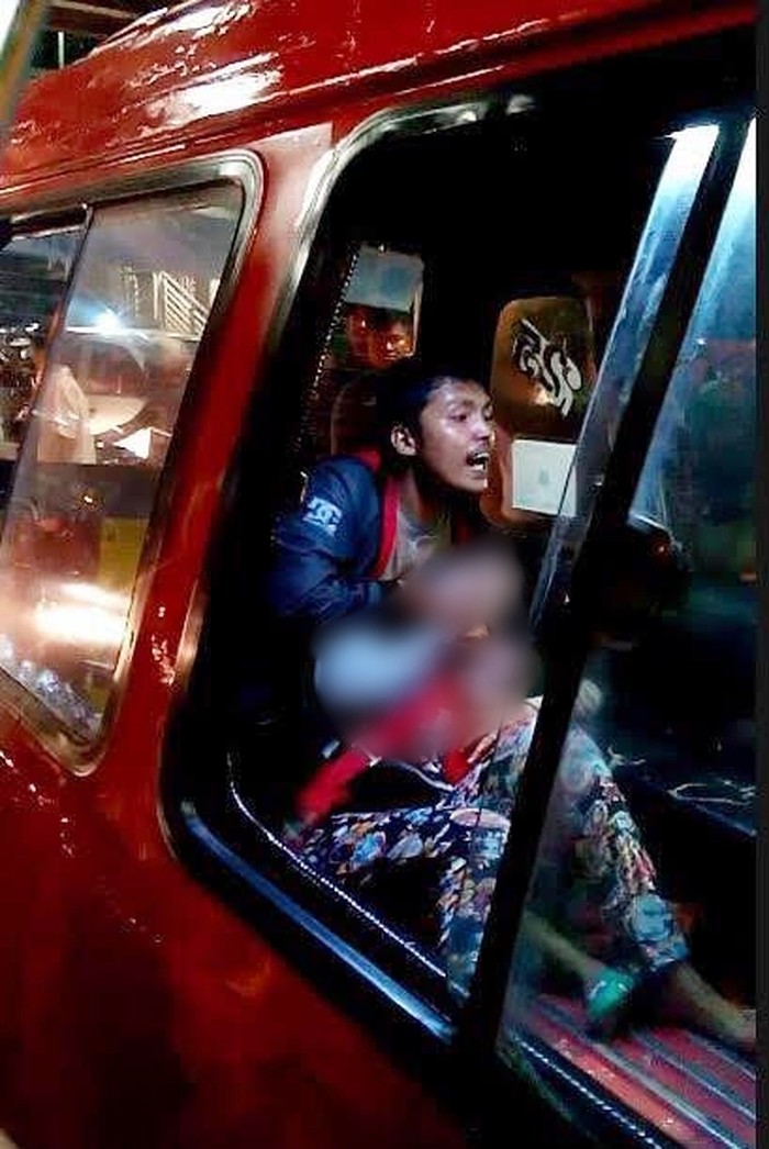 Luka Bayi Dafa Korban Penodongan Tak Tembus Sampai Dalam