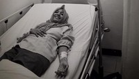Renita Sukardi mulai merasakan ada keanehan dalam tubuhnya pada 2014 lalu, saat itu ia merasa ada benjolan di payudaranya. (Dok. Instagram/irensukardi)