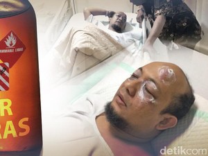 Diduga Terkait e-KTP, Siapa Peneror Novel Baswedan?