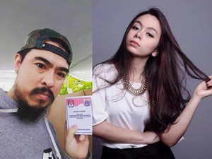 Sama Seperti Novel Baswedan, 2 Artis Ini Juga Pernah Disiram Air Keras