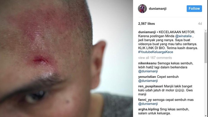 Tidak Turuti Istri, Anji Jatuh Dari Motor