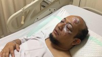 Novel Baswedan disiram air keras oleh 2 orang yang mengendarai sepeda motor usai salat subuh di Masjid Al Ihsan yang berjarak sekitar 4 rumah dari rumah Novel pada 11 April 2017. Rumah Novel sendiri berada di Jalan Deposito T nomor 8, RT 03 RW 10, Pegangsaan Dua, Kelapa Gading, Jakarta Utara. Dia kemudian dibawa ke RS Mitra Keluarga Kelapa Gading (Foto: Dok. Istimewa)