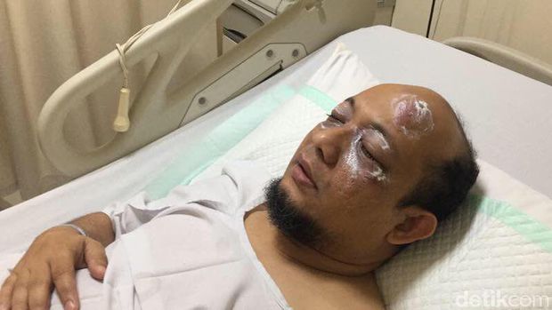 Kisah Novel Baswedan: Diteror, Difitnah Lalu Dipolisikan
