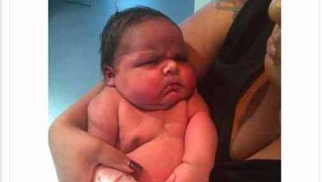 Fakta-fakta Soal Bayi yang Lahir Super Gede