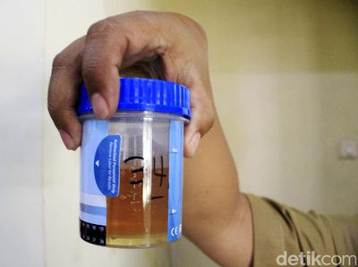 400 PNS Pemkab Bandung Tes Urine