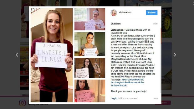 Gadis Ini Tampil di Ajang Kecantikan untuk Kenalkan Penyakit Langka