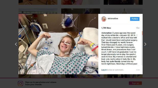 Gadis Ini Tampil di Ajang Kecantikan untuk Kenalkan Penyakit Langka