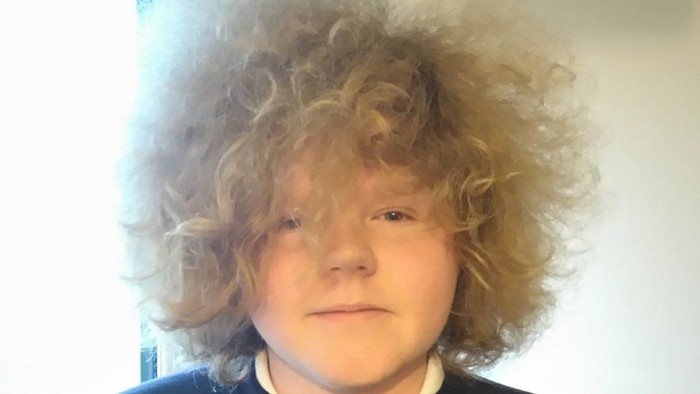 Botaki Kepala untuk Solidaritas Kanker, Siswa Inggris Dihukum