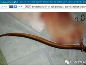 Astaga! Belut Dimasukkan ke Anus untuk Atasi Sembelit