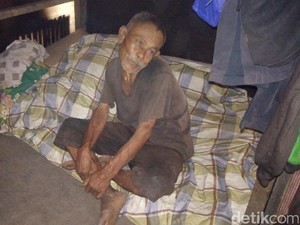 Cerita Penyakit Aneh Abah Tarsa yang Huni Gubuk Derita di Bandung