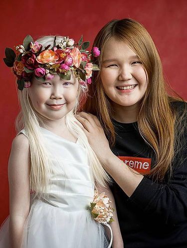 Foto: Nariyana, Putri Salju dari Siberia yang Menarik Atensi Dunia