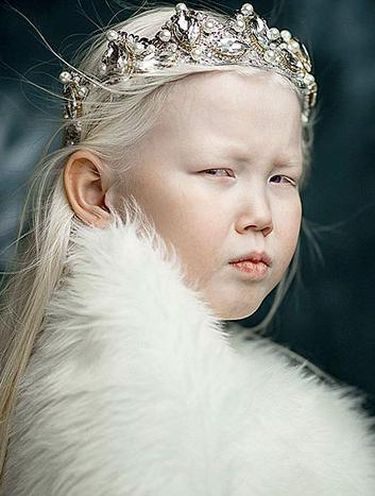 Foto: Nariyana, Putri Salju dari Siberia yang Menarik Atensi Dunia