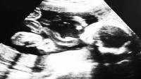 Its a Boy! tulis Pinkan Mambo di caption foto hasil USG yang diunggahnya. (Dok. Instagram/pinkan_mambo)